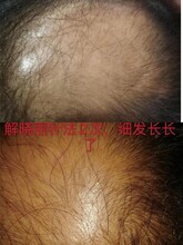 昆明举办解晓丽奇氏阴阳针灸减肥临床技术研修班
