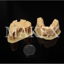 高精桌面级牙科牙模3D打印机